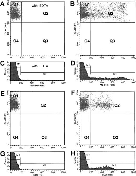 Fig. 1. Flow cytometric analyses of PS+ and CD36+ erythrocytes from a representative patient with SCD. / For the analysis of PS+ RBCs, dot plots of anti-CD235a–PE fluorescence and annexin V–FITC fluorescence from an RBC preparation stained in the presence of EDTA and calcium are presented in panels A and B, respectively. PS− (quadrant Q1) and PS+(quadrant Q2) dot plot regions were set using the erythrocyte sample stained in the presence of EDTA (A). Corresponding histogram profiles of annexin V–FITC fluorescence are presented in panels C and D, respectively. PS− (gate M1) and PS+ (gate M2) histogram regions were set using the RBC sample stained in the presence of EDTA (C). Values obtained for PS+ RBCs from both dot plot and histogram analyses were identical. For the analysis of CD36+ erythrocytes, dot plots of anti-CD235a–PE fluorescence and either FITC fluorescence from an isotype-matched negative control antibody or anti-CD36–FITC fluorescence from an RBC preparation are presented in panels E and F, respectively. Corresponding histogram profiles of FITC fluorescence from RBCs stained with the negative control antibody and anti-CD36 are presented in panels G and H, respectively. Events in quadrant Q1 (F) and gate M1 (H) represent CD36− RBCs, and those in quadrant Q2 (F) and gate M2 (H) are from the CD36+ erythrocytes. Analyses procedures similar to those described for PS+ RBCs were also used to assess data related to CD36 presented in panels E through H.