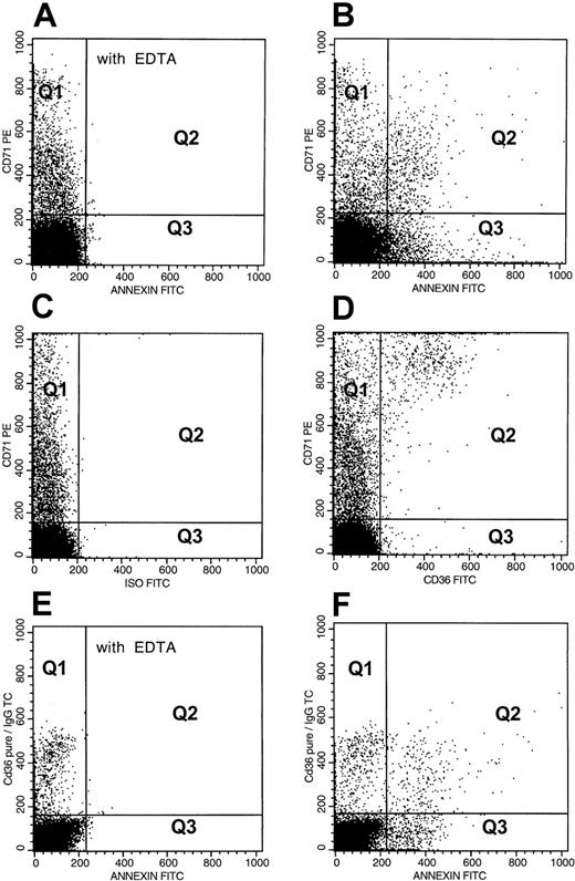 Fig. 2. Flow cytometric analyses of adhesion marker–positive stress reticulocytes and double adhesion marker–positive erythrocytes from a representative patient with SCD. / For analysis of PS+ stress reticulocytes, dot plots of anti-CD71–PE fluorescence and annexin V–FITC fluorescence from an RBC preparation stained in the presence of EDTA and calcium are presented in panels A and B. PS− (Q1) and PS+ (Q2) dot plot regions were set using erythrocytes stained in the presence of EDTA (A). The events in quadrants Q1 and Q2 (B) represent PS− and PS+ stress reticulocytes, whereas Q3 and Q4 represent PS+ and PS− nonreticulocytes. The following analyses were made: (1) Percent PS+ stress reticulocytes in the total stress reticulocyte fraction = (Q2 × 100)/(Q1 + Q2); (2) Percent PS+ stress reticulocytes in the total PS+ RBC fraction = (Q2 × 100)/(Q2 + Q3); (3) Percent PS+ stress reticulocytes in the total RBC fraction = (Q2 × 100)/(Q1 + Q2 +Q3 +Q4). Analyses of CD36+ stress reticulocytes (C,D) were performed in a manner similar to that described above for PS relationships. CD36− (Q1) and CD36+ (Q2) dot plot regions were set using erythrocytes stained with anti-CD71–PE and FITC-labeled negative isotype (C). For analysis of erythrocytes positive for both PS and CD36, dot plots of mouse anti-CD36–pure plus goat anti–mouse IgG–TC fluorescence and annexin V–FITC fluorescence from an RBC preparation stained in the presence of EDTA and calcium are presented in panels E and F. The quadrants in panel F represent PS− and CD36+ RBCs (Q1), erythrocytes positive for both PS and CD36 (Q2), CD36− and PS+ RBCs (Q3), and erythrocytes negative for both PS and CD36 (Q4). Data were analyzed in a manner similar to that presented above for PS+ stress erythrocytes.