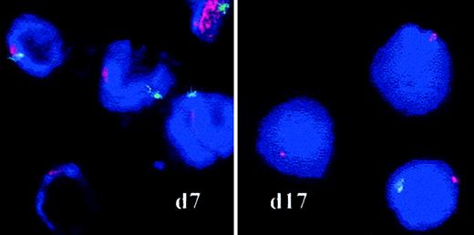 Fig. 4. FISH on interphase nuclei. / Chromosomes X and Y (RAEB sample 1) were analyzed by FISH with red (X) and green (Y) centromere-specific probes on culture days 7 and 17. Spots were counted on a minimum of 500 cells by 2 independent investigators. Original magnification, × 100.