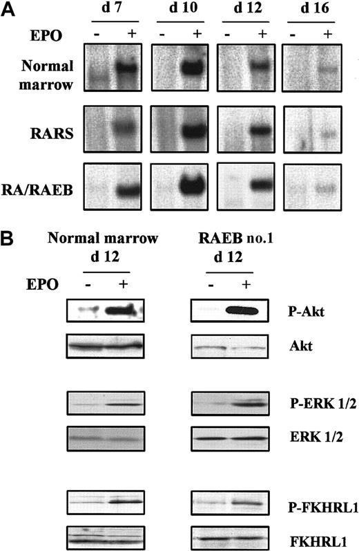 Fig. 5. Epo signaling in MDS and normal erythroid progenitors. / Cells were removed from serum and cytokines for 4 hours at 37°C and then stimulated for 10 minutes with 10 IU/mL Epo at 37°C. (A) Kinetics of Epo-induced STAT5 activation analyzed by electrophoretic mobility shift assay. (B) Western blot analysis of phospho-Akt, phospho-ERK 1/2, and phospho-FKHRL1 on day 12. Western blot results with Akt, ERK 1/2, and FKHRL1 were used as controls for protein loading. Data are representative results from 3 normal and 5 MDS samples.