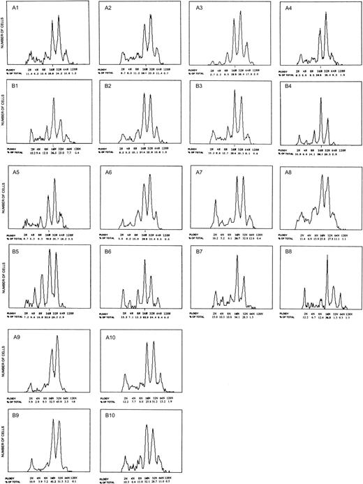 Fig. 2. Ploidy distribution of marrow megakaryocytes from patients with essential thrombocythemia. / Panels A1-10 show the ploidy distribution for each patient prior to anagrelide therapy. Increased MK ploidy was observed in all patients with a modal ploidy of 32N. Response to anagrelide was associated with decreased MK ploidy (corresponding panels B1-10). The modal ploidy was shifted from 32N to 16N as in healthy controls. The decreased ploidy correlated with a reduction in cell size and circulating platelet count.