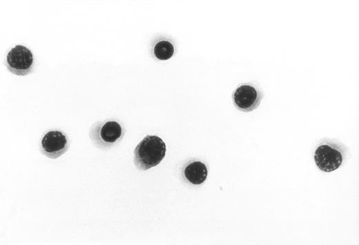 Fig. 4. Sorted NEPs. / To further confirm the identity of the NEPs shown in Figure 3, the cell population marked (B) was directly sorted and stained with Wright-Giemsa. The results show pure nucleated red blood cell precursors. Original magnification, × 1000.