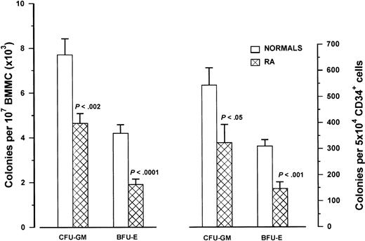 Fig. 2. Clonogenic progenitor cells in RA patients. / The left bars represent the mean number (± SD) of CFU-GM and BFU-E obtained by 107 BMMCs in 25 patients with RA and 25 healthy controls using clonogenic progenitor cell assays. The right bars represent the mean colony values (± SD) obtained by 5 × 104 highly purified immunomagnetically sorted CD34+ cells in 12 patients with RA and 21 healthy controls. Comparison between patient and control values was performed by means of the nonparametric Mann-Whitney test.