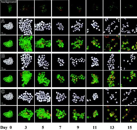 Fig. 1. Localization and expression of STAT3 and CD15 proteins during ex vivo granulocytic differentiation. / CD34+ cells from mobilized peripheral blood were directed along the granulocyte lineage with SCF, IL-6, G-CSF, with or without IL-3, and harvested for analysis by dual-color immunofluorescence microscopy. Detection of STAT3 and CD15 in cultures at (A) 5% O2, pH 7.25, +IL-3 (control condition); (B) 5% O2, pH 7.4, +IL-3 (high pH); and (C) 5% O2, pH 7.25, −IL-3. Negative controls (background) for each day of analysis using FITC- and Texas Red–conjugated secondary antibodies in the absence of the relevant primary antibodies are shown in the first row. The same field of cells is shown in the upper and lower panels of panels A-C. Upper panels of panels A-C: DAPI staining of nucleic acid (white). Lower panels of panels A-C: codetection of STAT3 (green) and CD15 (red) using polyclonal rabbit anti-STAT3 and monoclonal mouse anti-CD15 primary antibodies, followed by FITC-conjugated goat antirabbit IgG and Texas Red–conjugated goat antimouse IgM μ-chain–specific secondary antibodies. Images were captured using a × 40 oil immersion objective and are representative of 3 randomly selected fields per culture condition for each of 3 different sets of experiments. No appreciable differences in STAT3 and CD15 staining were visible in cells cultured at 20% O2 versus the control condition (data not shown). A 10-μm scale bar is shown in the day 0 panels.