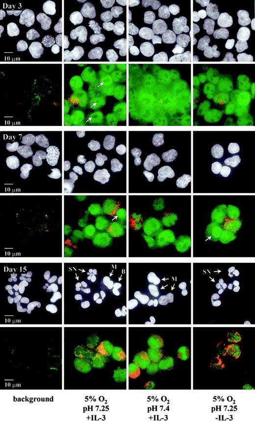 Fig. 2. IL-3 and pH modulate STAT3 and CD15 expression as well as changes in nuclear morphology during granulocytic differentiation. / Similar to Figure 1, except that immunofluorescence was evaluated on days 3, 7, and 15 of culture for images captured using a × 100 oil immersion objective. Images are representative of 2 randomly selected fields per culture condition for each of 3 different sets of experiments. The same field of cells is shown in the upper and lower panels of each day for each culture condition. Left panels: negative control (background) using FITC- and Texas Red–conjugated secondary antibodies in the absence of the relevant primary antibodies. Upper panels of each day: DAPI staining of nucleic acid (white). Lower panels of each day: codetection of STAT3 (green) and CD15 (red) using polyclonal rabbit anti-STAT3 and monoclonal mouse anti-CD15 primary antibodies, followed by FITC-conjugated goat anti–rabbit IgG and Texas Red–conjugated goat anti–mouse IgM μ-chain–specific secondary antibodies. DAPI staining indicates that cells sequentially exhibit features characteristic of typical granulocytic maturation—from the enlarged nucleus of the immature myeloblast to the lobulated nucleus of the mature neutrophil—with their progression dependent on the culture conditions. Arrows in day 3 panels indicate nucleoli. Arrows in day 7 panels indicate the decreased nuclear-cytoplasmic ratio of the myelocyte stage. Arrows in day 15 panels indicate typical nuclear morphology of metamyeloctyes (M), bands (B), and segmented neutrophils (SN). Advancement through the morphologic transitions did not appear different at 20% O2 compared with control cultures (data not shown). Ten-micrometer scale bars are shown in the negative control panels.