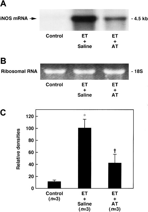 Fig. 7. Effect of AT on increase in the lung level of iNOS mRNA 180 minutes after ET administration in rats. / AT (250 U/kg) was administered intravenously 30 minutes prior to ET (5 mg/kg) administration. Control animals were administered saline alone. The iNOS mRNA expression in the lungs was determined 180 minutes after ET administration. (A) Chemiluminograms of typical expression of iNOS mRNA (4.5 kb) in each experimental group; (B) ethidium bromide staining of 18S ribosomal RNA (1 μg of total RNA per each lane). (C) The chemiluminograms of expression of iNOS mRNA were quantified by comparison with the mean value seen in the ET plus saline group, arbitrarily set at 100. Data are expressed as means ± SD of 3 animals. *P < .01 versus control. †P < .05 versus ET plus saline.