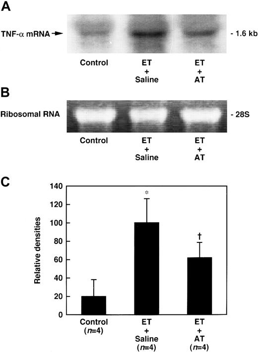 Fig. 11. Effect of AT on increase in the lung level of TNF-α mRNA 60 minutes after ET administration in rats. / AT (250 U/kg) was administered intravenously 30 minutes prior to ET (5 mg/kg) administration. Control animals were administered saline instead of ET. Expression of TNF-α mRNA in the lungs was determined 60 minutes after ET administration. (A) Chemiluminograms of typical expression of TNF-α mRNA (1.6 kb) 60 minutes after ET administration; (B) ethidium bromide staining of 28S ribosomal RNAs (3 μg of total RNA per each lane). (C) The chemiluminograms were quantified by comparison with the mean value seen in the ET plus saline group, arbitrarily set at 100. Data are expressed as means ± SD of 4 animals. *P < .01 versus control. †P < .05 versus ET plus saline.