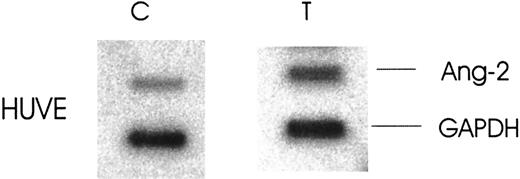 Fig. 4. Effect of thrombin on nuclear transcription of Ang-2 mRNA. / HUVE cells were treated with and without 1 U/mL thrombin for 3 hours, lysed, and nuclei extracted. Radiolabelled run-on RNAs were synthesized from isolated nuclei and hybridized to immobilized complementary DNA for Ang-2 and GAPDH (internal loading control).