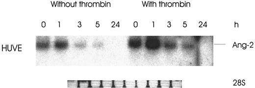 Fig. 5. Effect of thrombin on Ang-2 mRNA stability. / Cells were treated with and without 1 U/mL thrombin for 3 hours, followed by addition of 5 μg/mL actinomycin D to inhibit RNA synthesis. Northern analysis was then performed at various time intervals of 1 to 24 hrs.