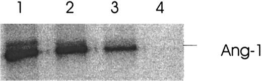 Fig. 7. Effect of thrombin-induced Ang-2 on binding of Ang-1 to its Tie-2 receptor. / HUVE cells were treated with 1 U/mL thrombin for 5 hours and the concentrated supernatant incubated with 35S–Ang-1 prior to binding of Ang-1 to Tie-2–Fc. Binding was analyzed by autoradiography following immunoprecipitation with protein A and 12% SDS–polyacrylamide gel electrophoresis. Lane 1, 35S–Ang-1 plus Tie-2–Fc. Lane 2, 35S–Ang-1 plus supernatant of thrombin-hirudin–treated HUVE cells. Lane 3, 35S–Ang-1 plus supernatant of thrombin-treated HUVE cells. Lane 4, absence of Tie-2–Fc in the system. Representative of 3 experiments.
