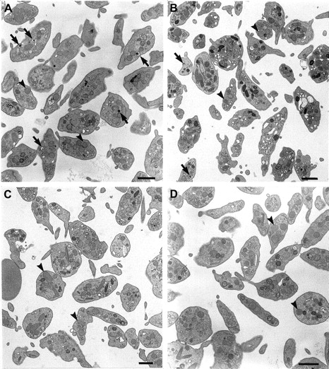 Fig. 4. Platelets of double mutant mice have normal ultrastructure, other than a lack of dense granules. / Platelets of normal C57BL/6J (A), pale ear (ep/ep) (B), pearl (pe/pe) (C), and double mutant (ep/ep, pe/pe) (D) mice were analyzed by electron microscopy. Dense granules (arrows) are common in normal platelets, less so in pale ear and are not apparent in pearl or double mutant cells. The α granules (arrowheads) are equally common in both qualitative and quantitative senses in all platelet genetic types. Bars represent 1 μm.