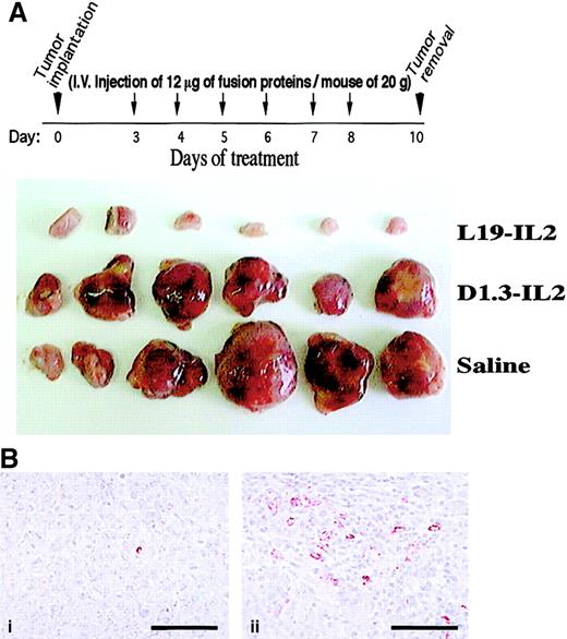 Fig. 3. Treatment of tumor-bearing mice with L19–IL-2 or D1.3–IL-2 fusion proteins. / (A) Upper part: treatment schedule of mice. Treatment began 72 hours after F9 murine teratocarcinoma implantation in syngeneic mice; mice received daily intravenous injections of 12 μg L19–IL-2 or D1.3–IL-2 corresponding to 72 000 IU, or saline for 6 consecutive days. Animals were killed on the 10th day. The photograph shows the F9 tumors dissected from the different groups of animals. (B) Immunohistochemistry using a rat antimouse CD 45R/B220 antibody of the F9 tumor from a mouse treated with D1.3–IL-2 (i) and from a mouse treated with L19-IL-2 (ii). Scale bar indicates 30 μm.