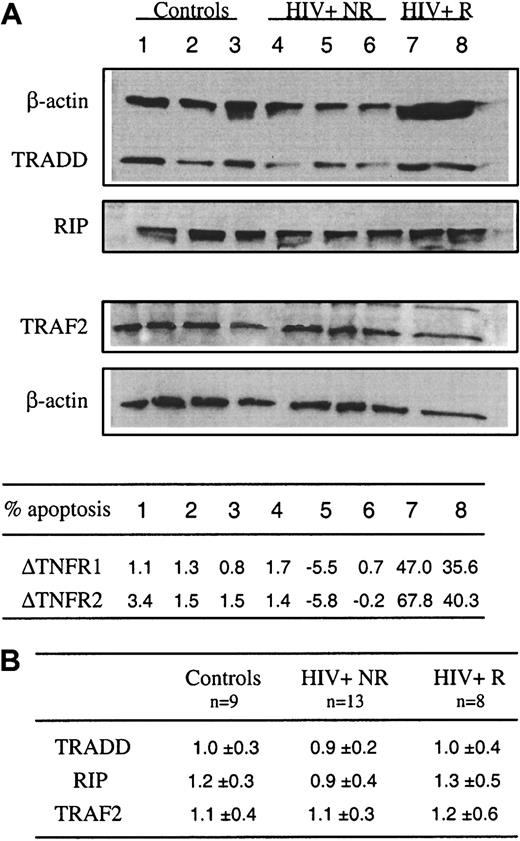 Fig. 4. Constitutive expression of RIP, TRADD, and TRAF-2 in blood T lymphocytes from control donors and HIV-infected patients. / (A) Ex vivo expression of TRADD, RIP, and TRAF-2 was assessed by Western blot analysis from whole cell extracts prepared from sorted CD2+ T cells. As a control, β-actin expression is reported for each donor for TRADD and RIP (upper part) and TRAF2 (lower part) expression after restripping of each membrane. Data are shown for 3 controls (lanes 1-3), 5 HIV-1+ patients including 3 nonresponders (NR) (lanes 4-6) and 2 responders (R) (lanes 7 and 8) to TNFR1- and TNFR2-mediated apoptosis. In the same experiment, the percent of T-cell apoptosis was determined in response to TNFR1 or TNFR2 ligation, as described in the legend of Figure 1. Data are given as Δ of apoptosis corresponding to percent apoptosis in TNFR-stimulated cultures minus percent apoptosis in medium. (B) Scanning of autoradiograms has been performed using Color It !TM 3.0. The values were obtained using the NIH Image 1.62b7. Data represent the ratio of the peak area for each protein divided by the peak area for actin.