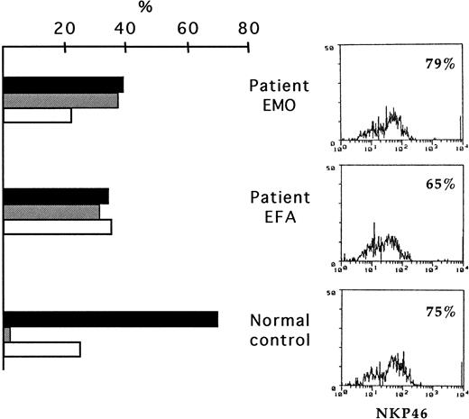 Fig. 1. Expression of NKp46 in freshly derived NK cells from TAP2−/− patients. / PBMC from the patients and from a healthy control donor were depleted of CD3+, HLA-DR+, and adherent cells and were analyzed by double fluorescence for the expression of NKp46, CD56, and CD16. This analysis led to the identification of different NK cell subsets. Histograms on the left show the percentages of the CD56+CD16+NKp46bright cells (black bars), CD56brightCD16−NKp46brightcells (gray bars), and CD56+CD16+NKp46dull cells (white bars) in the 2 patients and in the healthy donor. Cytofluorometric profiles on the right show the overall surface expression of NKp46 in the same donors.