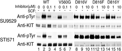Fig. 1. Differential sensitivity of RT, EST, and differently substituted codon 816 mutant KIT to KIT inhibitors. / Antiphosphotyrosine blots of immunoprecipitated KIT expressed in COS cells show a low level of spontaneous phosphorylation of wild-type (WT) KIT (lane 1), which increases in response to SCF stimulation (lane 2). Both inhibitors at 0.1 to 1 μM prevent this ligand-induced phosphorylation (lanes 3-4). RT mutant KIT with Val560Gly substitution shows a high level of SCF-independent phosphorylation (lane 5), and the phosphorylation is inhibited by both inhibitors at physiologically achievable (0.1-1 μM) concentrations (lanes 6-7). The EST Asp816Val mutation commonly found in human mastocytosis also shows high spontaneous phosphorylation (lane 8) but is resistant to inhibition by either KIT inhibitor at 1 to 10 μM (lanes 9-10). Substitution of phenylalanine or tyrosine for aspartate 816, rarely found in human mastocytosis, also results in high spontaneous phosphorylation (lanes 11, 14), but these 2 mutant variants respond to the inhibitors at 1 to 10 μM (lanes 12-13, 15-16) unlike Asp816Val KIT. However, they are still an order of magnitude less sensitive than are RT mutant or wild-type KIT and are not valid therapeutic targets with currently available drugs.
