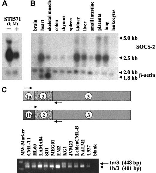 Fig. 1. SOCS-2 expression in human tissue and cell lines. / (A) Northern blot of KYO1 cells exposed (+) or not (−) to 1 μM STI571 for 10 hours. (B) Multiple-tissue Northern blot (Clontech) probed with SOCS-2. (C) Primer design and RT-PCR amplification of alternatively spliced variants ofSOCS-2.