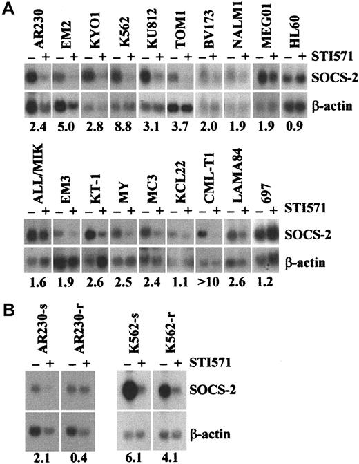 Fig. 2. Differential expression of SOCS-2 in human leukemic cell lines. / (A,B) Northern blot of human leukemic cell lines exposed (+) or not (−) to 1 μM STI571 for 3 to 24 hours. Numbers below the blots represent the densitometric analysis of SOCS-2 levels, expressed as the ratio SOCS-2/β-actin before (−) and after (+) exposure to STI571.
