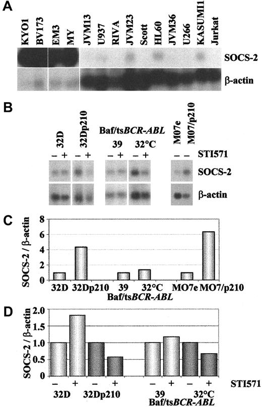Fig. 4. SOCS-2 expression in. / BCR-ABL–positive as compared withBCR-ABL–negative cell lines. The upper 2 panels show Northern blots hybridized with SOCS-2 and β-actin of (A) human hematopoietic cell lines, (B) human and murineBCR-ABL–transfected cell lines and their parental counterparts exposed (+) or not (−) to 1 μM STI571 for 10 to 24 hours. The lower 2 panels show densitometric analyses ofSOCS-2/β-actin signals from the Northern blots in panel B: (C) baseline expression in cells not exposed to STI571, demonstrating up-regulation of SOCS-2 in BCR-ABL–positive cells (for comparative purposes, the SOCS-2 signals inBCR-ABL–negative lines were normalized to 1); (D)SOCS-2 down-regulation upon STI571 treatment (for comparative purposes, SOCS-2 levels in nonexposed cells were normalized to 1).