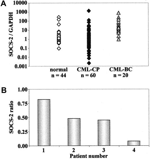 Fig. 5. SOCS-2 expression in primary CML blast cells. / Real-time RT-PCR for SOCS-2 of cDNA samples from patients with CML in CP or BC or from healthy individuals. Results have been normalized by comparison to their GAPDH mRNA expression. (A) cDNA samples from patients with CML in CP or BC and from healthy individuals. (B) cDNA samples from 4 patients with CML in BC during treatment with STI571. Data are compared with the gene expression levels before initiation of therapy.