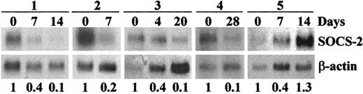 Fig. 6. SOCS-2 mRNA expression in patients with CML in BC responding to STI571 therapy. / Northern blots of RNA from 5 patients with CML in myeloid BC before and during STI571 therapy, probed with SOCS-2 andβ-actin. The numbers below the blots refer to the densitometric calculation of SOCS-2 levels, normalized toβ-actin. For interindividual comparison of samples, levels before therapy were defined as being 1, and levels under therapy were compared with that value.