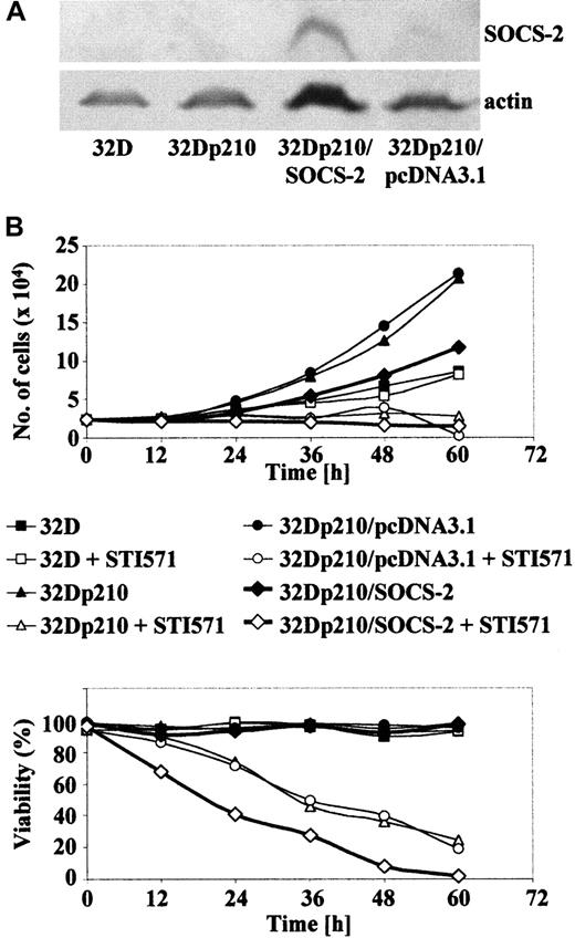 Fig. 9. SOCS-2 overexpression slows cell growth and sensitizes cells to STI571-induced death. / (A) Protein extracts from 107 cells were separated on a 12% SDS-PAGE gel and stained for SOCS-2 and actin. (B) 2.5 × 104 cells/mL were seeded in tissue culture flasks with or without 1 μM STI571. Cell proliferation (top panel) and viability (bottom panel) were assessed by trypan blue staining. Cultures were fed every 48 hours as required.