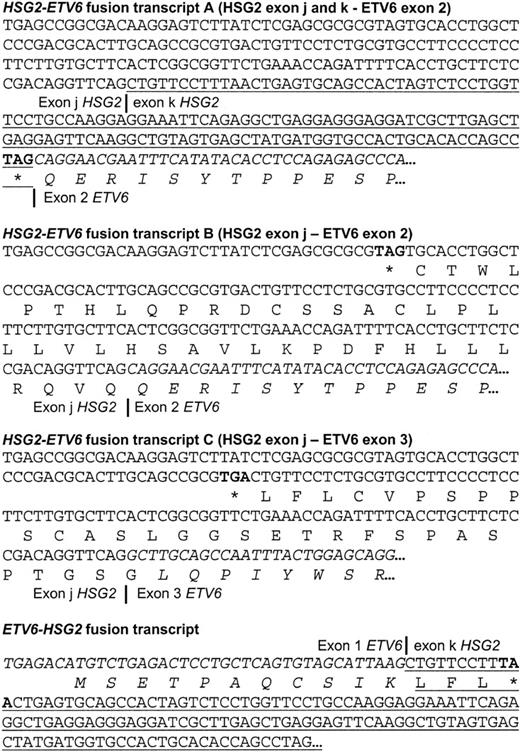 Fig. 2. RACE results for case 5 indicating the different. / HSG2-ETV6 andETV6-HSG2 fusions. The 5′- and 3′-RACE, performed on cDNA obtained from case 5, revealed the existence of 3 differentHSG2-ETV6 fusion transcripts and an ETV6-HSG2fusion transcript. Exon 2 of ETV6 and exon k ofHSG2 are present in both types of fusions, which can only be explained by a duplication event associated with the translocation. Exon k of HSG2 is underlined; sequences from ETV6are in italics; stop codons are in bold.
