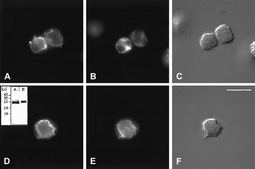Fig. 3. Subcellular localization of HBP by immunofluorescence microscopy. / Indirect immunolocalization of HBP and markers for azurophilic granules and secretory vesicles. Neutrophils were fixed, permeabilized, and stained, as described in “Materials and methods,” before attachment to poly-L-lysine–coated coverslips and recording of images. (A-C) Cells were incubated with a rabbit anti-HBP antibody and a mouse monoclonal antibody against the azurophilic granule marker, CD63. (D-F) Cells were incubated with a rabbit anti-HBP antibody and a mouse monoclonal antibody against the secretory vesicle marker, CD35. Thereafter, the cells were stained with FITC-labeled anti-rabbit and Cy3-labeled anti-mouse secondary antibodies. Staining of HBP (A, D), CD63 (B), and CD35 (E). Corresponding Nomarski images (C, F). Results are representative of more than 5 separate experiments. (Bar = 10 μM). (inset) Specificity of the rabbit anti-HBP antibody was verified by Western blot analysis of neutrophil lysates (inset, B). As a control, purified recombinant HBP was used in inset A.