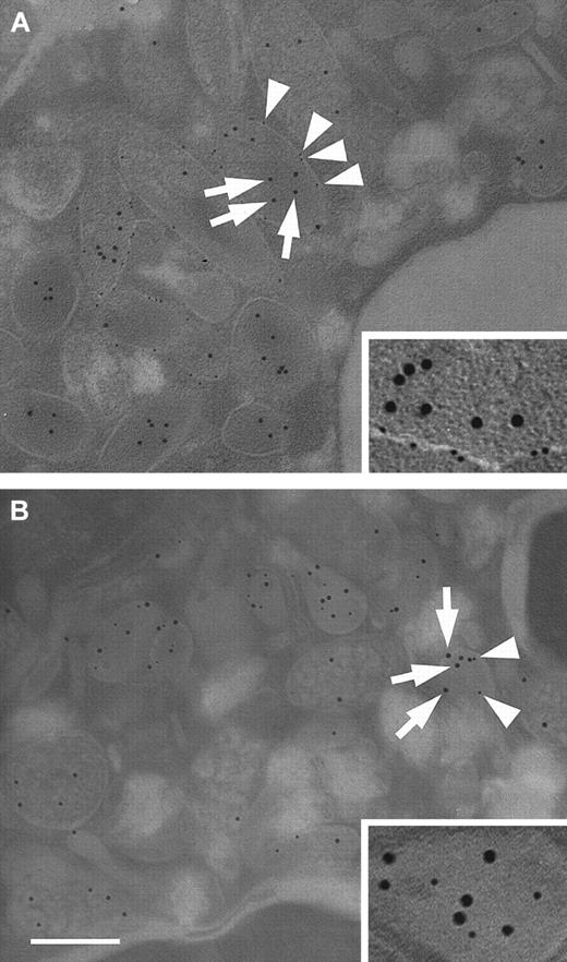Fig. 5. Subcellular localization of HBP by electron microscopy. / Neutrophils were fixed and prepared for transmission electron microscopy as described in “Materials and methods.” (A) Neutrophils were immunostained with a monoclonal antibody against ALP and a rabbit polyclonal antibody against HBP. Bound antibody was detected with gold-labeled secondary antibodies against mouse IgG (6-nm gold particles) and rabbit IgG (10-nm gold particles), respectively. Arrows indicate HBP, arrowheads indicate ALP. (inset) Secretory vesicle containing HBP at a higher magnification. (B) Neutrophils were immunostained with a monoclonal antibody against MPO and a polyclonal antibody against HBP, as described above. Arrows indicate HBP, arrowheads indicate MPO. (inset) Azurophil granule containing HBP at a higher magnification. Images are representative of 4 separate experiments. Bar = 200 nm.