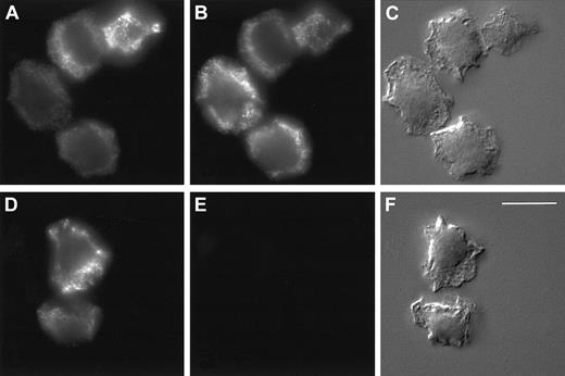 Fig. 8. Localization of HBP by immunofluorescence microscopy in HL60 cells. / Indirect immunolocalization of HBP and markers for azurophilic granules and secretory vesicles. HL60 cells were fixed, permeabilized, and stained, as described in “Materials and methods,” before attachment to poly-L-lysine–coated coverslips and recording of images. (A-C) Cells were incubated with a rabbit anti-HBP antibody and a mouse monoclonal antibody against the azurophilic granule marker, CD63. (D-F) Cells were incubated with a rabbit anti-HBP antibody and a mouse monoclonal antibody against the secretory vesicle marker, CD35. Thereafter, the cells were stained with FITC-labeled anti-rabbit and Cy3-labeled anti-mouse secondary antibodies. Staining of HBP (A, D), CD63 (B), and CD35 (E). Corresponding Nomarski images (C, F). Results are representative of 3 separate experiments. Bar = 10 μM.