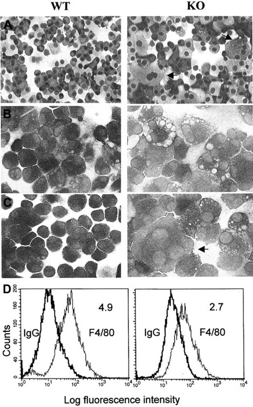 Fig. 2. Morphologic characteristics and expression of the macrophage-specific marker F4/80 in macrophages from wild-type (WT) and C/EBPε−/− (KO) mice. / Cytocentrifugation preparations from cultured bone marrow macrophages stained with (A) Wright-Giemsa stain (original magnification, ×200), (B) nonspecific esterase (unstimulated cells, original magnification, ×400), and (C) nonspecific esterase (after stimulation of the cells for 24 hours with LPS). Arrows indicate large multinucleated macrophages (after culturing C/EBPε−/− cells in the presence of rIL-3 and rGM-CSF for 11 to 14 days. These photomicrographs are representative of the results obtained from 3 independent experiments. (D) Histograms of total fluorescence binding of phycoerythrin-conjugated F4/80 (right peak) versus isotype-matched control antibody samples (left peak). Mean fluorescence intensity ratios (total fluorescence divided by control) are shown in the upper right-hand corner of each histogram.