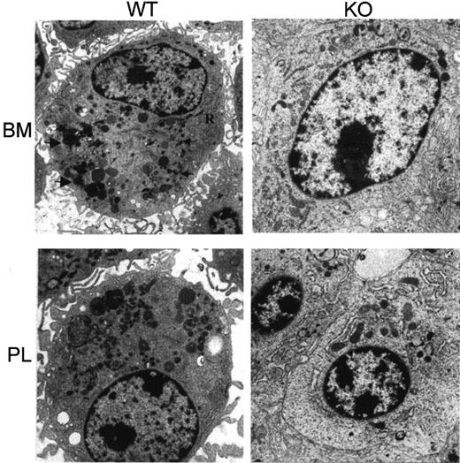 Fig. 3. Electron micrograph of macrophages from wild-type and C/EBPε knockout mice. / (Upper panel) Wild-type bone marrow (BM)–derived macrophages that have abundant rough endoplasmic reticulum (R) and numerous primary (small arrowheads) and larger secondary lysosomes (large arrowheads) (×6000). In contrast, the knockout macrophages have fewer cisternae of rough endoplasmic reticulum and a paucity of secondary lysosomes (×8050). (Lower panel) Ultrastructure of wild-type thioglycollate-elicited macrophages (PL) and C/EBPε knockout cells (right)