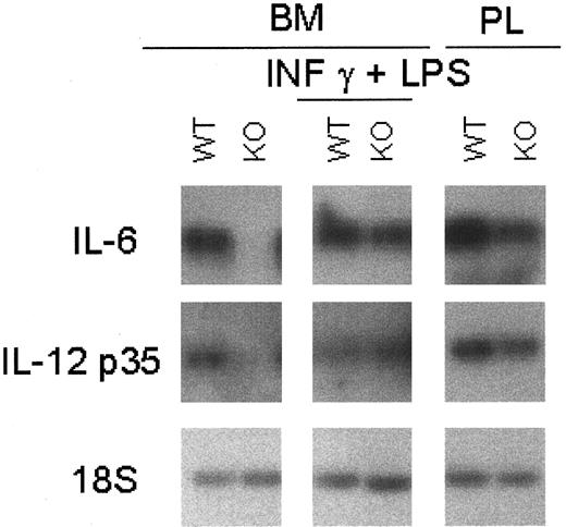 Fig. 6. Cytokine mRNA expression in C/EBPε−/− macrophages. / Macrophages were harvested from PL 24 hours after thioglycollate challenge and from bone marrow cells cultured for 13 days with and without stimulation with 2-hour LPS (1 μg/mL) plus IFN-γ (100 U/mL) stimulation. Macrophage-mediated cytokines were measured by RT-PCR because of the low basal level of expression. PCR products were blotted and hybridized using internal oligonucleotide 32P-labeled probes specific for the amplified genes.