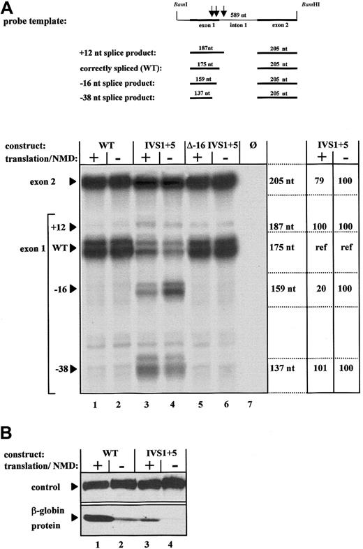 Fig. 2. Expression analysis of the aberrantly spliced human β-globin transcripts under conditions of enabled and disabled NMD. / (A) RPAs using total RNA of cells transfected with either the normal human β-globin gene (WT, lanes 1 and 2), a gene with the IVS1 + 5 G>A mutation (IVS1 + 5, lanes 3 and 4), or a gene with the IVS1 + 5 G>A mutation and inactivation of the cryptic splice site at position −16 (Δ −16 IVS1 + 5, lanes 5 and 6). NMD was specifically enabled by iron treatment of transfected cells (lanes 1, 3, and 5) or specifically disabled by iron depletion (lanes 2, 4, and 6). Lane 7 represents the analysis of RNA from untransfected HeLa cells. The protected fragments of 205 nts, 187 nts, 175 nts, 159 nts, and 137 nts result from splicing at the normal splice site or the 3 cryptic splice sites, respectively. The 175-nt exon 1 fragment is specific for the normally spliced transcript, is unaffected by activation or inactivation of NMD, and serves as an internal reference for quantification of the aberrant transcripts (lanes 3 and 4) specifically represented by the 187-nt, 159-nt, and 137-nt fragments, respectively. The 205-nt exon 2 fragment reflects the cumulative expression of all 4 mRNA species derived from the parent pre-mRNA. Expression levels of the different species of mature transcripts of the IVS1 + 5 pre-mRNA are indicated in percentages relative to the internal reference (ref). (B) Immunoblot analysis of cells transfected with constructs WT and IVS1 + 5 under conditions of enabled and disabled translation.