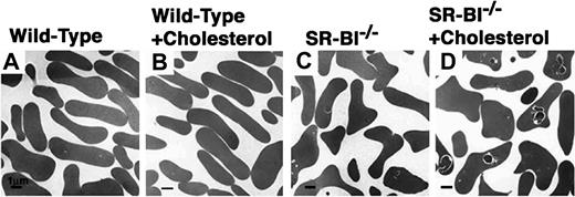 Fig. 2. Effects of cholesterol feeding on the morphology of red blood cells from wild-type and. / SR-BI−/− mice. Wild-type (panels A-B) and SR-BI−/− (panels C,D) mice were fed normal, low-cholesterol chow (panels A,C) or 1% cholesterol–supplemented chow (panels B,D) for 3 months. Then, red blood cells were prepared and examined by transmission electron microscopy. Bar = 1 μm.
