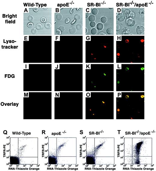 Fig. 4. Fluorescence microscopic and flow cytometric analysis of the characteristics of red blood cells from wild-type and mutant mice. / (A-P) Red blood cell preparations from wild-type,apoE−/−, SR-BI−/−, andSR-BI−/−/apoE−/− mice were simultaneously stained with 2 lysosomal markers: Lysotracker (low-pH indicator, red) and FDG (lysosomal beta-galactosidase substrate, green), and were examined by phase contrast (panels A-D) and fluorescence (panels E-P) microscopy. Panels E-H show Lysotracker staining; panels I-L, FDG staining; and panels M-P, merged red and green fluorescence images. Yellow indicates spatial overlap of the signals. (Q-T) Dual-color fluorescence flow cytometric analysis of red blood cells from the indicated mice stained with thiazole orange to detect RNA (x-axis) and a phycoerythrin-conjugated monoclonal anti-Trfr antibody to detect cell-surface Trfr (y-axis). For each cell analyzed, the relative intensities of thiazole orange fluorescence and phycoerythrin fluorescence are indicated by a dot and presented on log scales. Each panel represents analysis of 10 000 cells. Dots in the lower left quadrant of the cytogram represent double-negative, mature erythrocytes.