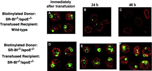Fig. 5. Fate of biotinylated erythrocytes from. / SR-BI−/−/apoE−/− mice transfused into wild-type andSR-BI−/−/apoE−/−recipients. A donorSR-BI−/−/apoE−/− mouse was injected with biotin to label erythrocytes in vivo. Samples of this blood were then injected into either wild-type (panels A-C) orSR-BI−/−/apoE−/− (panels D-F) recipient mice. Samples of blood from these recipient mice were taken immediately after infusion (panels A,D), at 24 hours (panels B,E), and at 48 hours (panels C,F), and the cells were labeled with Lysotracker. Blood cells were analyzed by confocal microscopy showing biotin in red and Lysotracker in green. Immediately following transfusion, 9.4% of the cells in the wild-type recipient were labeled with biotin. This decreased to 9.1% at 24 hours and to 6.0% at 48 hours, for a 48-hour survival rate of 64%.