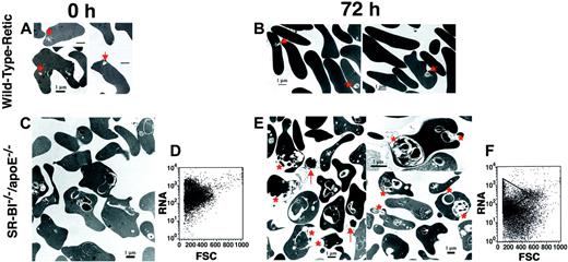 Fig. 6. Effects of in vitro incubation in normolipidemic serum on reticulocytes from phlebotomized wild-type mice and erythrocytes from. / SR-BI−/−/apoE−/−mice. Erythrocytes from wild-type mice with phlebotomy-induced reticulocytosis (panels A-B) and fromSR-BI−/−/apoE−/− mice (panels C,E) were incubated in vitro in medium containing 20% normolipidemic fetal calf serum for 0 hours (panels A,C) or 72 hours (panels B,E); the cells were then analyzed by transmission electron microscopy. The red asterisks show membrane-enclosed, cytoplasmic vesicles that appeared to be undergoing expulsion from theSR-BI−/−/apoE−/−erythrocytes (panel E). Arrows denote cell-free vesicles found in the incubation medium (panel E). Arrowheads show structures in reticulocytes from phlebotomized wild-type mice that appear similar to the cytoplasmic vesicles seen inSR-BI−/−/apoE−/− erythrocytes (panels A-B). Panels D and F show flow cytometry analysis of RNA content (thiazole-orange staining) versus forward scatter of the cells (FSC) forSR-BI−/−/apoE−/−samples at 0 hours (panel D) and 72 hours (panel F).