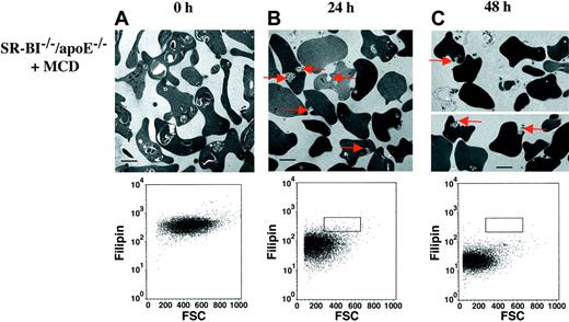 Fig. 7. Effects of MCD treatment on in vitro vesicle expulsion from erythrocytes from. / SR-BI−/−/apoE−/−mice. Erythrocytes fromSR-BI−/−/apoE−/− mice were preincubated for 5 minutes in medium with (this Figure) or without (not shown; however, see Figure 6) 0.1% MCD; cells were then incubated in vitro without MCD as described in Figure 6. Samples were taken before MCD treatment (panel A) and at 24 (panel B) and 48 (panel C) hours of incubation and analyzed by electron microscopy. At 24 hours (panel B) and 48 hours (panel C), the membrane-enclosed, cytoplasmic vesicles appear to be undergoing expulsion from theSR-BI−/−/apoE−/−erythrocytes (red arrows). The plots below each electron micrograph correspond to the photos above and show a decrease in filipin staining as plotted against FSC. The rectangles on the 24- and 48-hour plots show the position of the bulk population of cells at 0 hours. Preincubation without MCD (data not shown) gave results similar to those shown in Figure 6.