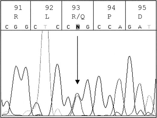 Fig. 5. A G376A polymorphism was identified in the Leu33 encoding β3 integrin allele from Donor A. / The complete ORFs of both αIIb and β3 integrins were sequenced from cDNA obtained from the platelets of Donor A. Sequencing identified a single, novel polymorphism in the β3 cDNA with adenine or guanine at position 376, for which Donor A is heterozygous. This SNP, indicated by the arrow, results in the replacement of arginine with glutamine at position 93 in the β3Leu33 allele.