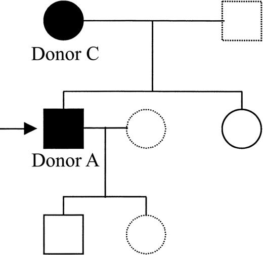 Fig. 8. Pedigree of Donor A's family showing members positive for the Gln93-encoding allele. / Genomic DNA samples were obtained from members of Donor A's immediate family and were genotyped for the presence of the Gln93 encoding β3 integrin allele. A complete HPA genotype was also obtained by PCR-SSP (data not shown). The mutant β3Gln93 integrin allele was found in the mother (Donor C) and in the proband. Black symbols represent β3Gln93-positive members, open symbols represent β3Gln93-negative members, and the arrow indicates the proband (Donor A). Samples were not available from members represented by broken symbols.