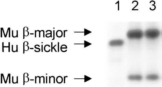 Fig. 3. Stable, complete replacement of the peripheral RBC compartment occurred in engrafted mice. / RBC chimerism is determined by hemoglobin electrophoresis. Recipient mice originally possessed only human sickle β-globin (lane 1), while donor mice possessed the major and minor alleles of mouse β-globin (lane 2). Lane 3 shows a representative engrafted mouse with complete peripheral replacement with donor β-globin. Complete replacement of the peripheral blood with donor hemoglobin occurred within 1 month after transplantation and was stable for the entire observation period (> 150 days) in all engrafted mice. Hu indicates human; Mu, murine.