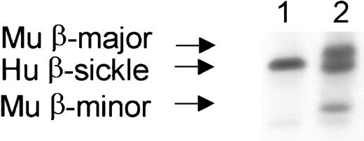 Fig. 4. A subset of 5 of 9 mice who received only costimulation blockade (no busulfan) developed significant RBC chimerism. / Lane 1 shows a representative mouse without engraftment, with only human β-sickle hemoglobin. Lane 2 shows a representative mouse 3 months after transplantation with RBC chimerism, having both recipient (human β-sickle hemoglobin) and donor (mouse major and minor β-hemoglobin alleles) RBCs. Hu indicates human; Mu, murine.