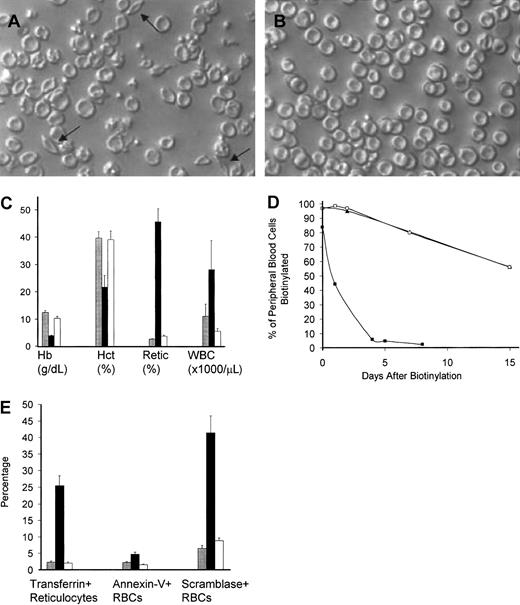 Fig. 6. Engrafted mice demonstrated a phenotypic cure of SCD. / Peripheral blood smear from representative untreated (A) and engrafted (B) animals, prepared under ambient air. Arrows point to representative irreversibly sickled cells in the untreated blood. Engrafted animals have a normal peripheral smear. Original magnification, × 250. (C) Hematologic parameters are normalized in engrafted mice. Normalization of hematologic parameters was present within 1 month after transplantation and was stable for the entire experimental period (> 150 days). Shown are the mean ± SEM for C57BL/6 controls (n = 6, ░), nonengrafted mice (n = 4, ▪), and engrafted mice (n = 7, ■) in a representative experiment performed 3 months after transplantation. Hb indicates hemoglobin; Hct, hematocrit; Retic, thiazole+ reticulocyte percent; WBC, white blood cell count. (D) Engrafted mice have a normal RBC half-life. Peripheral blood was biotinylated at time 0, and the decay of biotinylation in RBCs (identified as Ter-119+, CD45−, biotinylated cells) was monitored by flow cytometry. Untreated sickle animals (▪) had an exceedingly short RBC half-life, while engrafted animals (■) had an RBC half-life that was indistinguishable from normal C57BL/6 controls (▴). These data represent the average of 2 animals that were biotinylated 3 months after transplantation. (E) The engrafted RBC population is healthy as determined by normalization of the percentage of transferrin+ stress reticulocytes, PS exposure as measured by annexin V binding, and scramblase activity as measured by NBD-PC internalization. C57BL/6 control (░, n = 6), nonengrafted (▪, n = 4), and engrafted (■, n = 7) animals were analyzed. Shown are the mean ± SEM of animals analyzed 3 months after transplantation. Normalization of RBC parameters in engrafted animals occurred within 1 month after transplantation and was stable for the entire observation period (> 150 days).