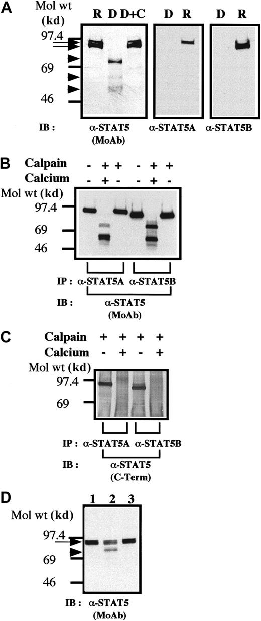 Fig. 1. STAT5 is cleaved by calpain in vivo and in vitro. / (A) Dibucaine treatment of platelets leads to cleavage of STAT5. The platelets were incubated with either calpeptin (20 μM) or dimethyl sulfoxide (DMSO; vehicle of calpeptin; final, 0.1%) for 5 minutes. The platelets were then treated with dibucaine (1 mM) for 15 minutes. Whole-platelet lysates (1.5 × 107 cells/lane) were analyzed by 7.5% to 15% gradient SDS-PAGE. The separated proteins were electrophoretically transferred from the gel to nitrocellulose membranes. STAT5 was detected by immunoblotting with a pan anti-STAT5 MoAb (left panel), anti-STAT5A (middle panel), or anti-STAT5B (right panel). Arrows indicate the relative position of intact STAT5; arrowheads show the positions of cleaved products of STAT5. R indicates control resting platelets; D, dibucaine-treated cells after incubation in DMSO; D + C, dibucaine plus calpeptin; and IB, immunoblotting. (B) In vitro cleavage of STAT5. STAT5 was precipitated by either anti-STAT5A or anti-STAT5B. The immunoprecipitates were untreated or incubated with purified μ-calpain in the presence or absence of calcium ion. After denaturing in SDS, STAT5 was detected by immunoblotting with a pan anti-STAT5 MoAb. (C) Truncated STAT5 molecules cleaved in vitro were not recognized by the anticarboxy-terminal domain of STAT5. IP indicates immunoprecipitation. Methods were the same as those as described in the legend for Figure 1B except that STAT5 was recognized by an antibody against the carboxy-terminal domain of STAT5. (D) Cleavage of STAT5 during platelet aggregation. Platelets were stimulated with thrombin (1 U/mL) for 30 minutes with or without stirring. After addition of ethyleneglycotetraacetic acid (5 mM) and EDTA (5 mM), platelets were lysed by boiling in SDS sample buffer. STAT5 was detected by immunoblotting as described in the legend for Figure 1A by using the pan anti-STAT5 MoAb. Lane 1 shows resting platelets; lane 2, results after thrombin stimulation of platelets for 30 minutes, with stirring, in the absence of Arg-Gly-Asp-Ser; and lane 3, results after thrombin stimulation for 30 minutes without stirring. The arrow indicates full-length STAT5 and the arrowhead a cleaved form of STAT5.