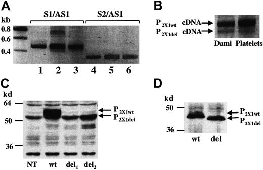 Fig. 1. Analyses of P2X1del mRNA and protein. / (A) RT-PCR of platelet (lanes 2 and 5) and Dami cell (lanes 3 and 6) RNA; the primer sets S1/AS1 and S2/AS1 are described by Greco et al.1 In lanes 1 and 4, the pcDNA3-P2X1wtplasmid was used as a PCR template. (B) Enlarged view of lanes 2 and 3. For these experiments, platelets were isolated from freshly drawn blood of at least 10 unrelated healthy volunteers. (C) Western blots of P2X1del and P2X1wt in transfected 1321N1 total cell extracts. The pcDNA3-P2X1del vector was transfected in 2 independent experiments (del1 and del2) in parallel with the pcDNA3-P2X1wt vector (wt). A nontransfected cell extract is also shown (NT). (D) Western blots of P2X1del (del) and P2X1wt (wt) proteins synthesized in a in vitro T7-coupled transcription/translation rabbit reticulocyte system. The rabbit polyclonal anti–human P2X1antibody used in these experiments was previously described.9 Bands corresponding to P2X1del and P2X1wt PCR products and proteins are indicated. Molecular weight ladder is shown on the left.