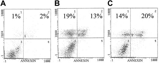 Fig. 2. Effects of AKT inhibitors on U266 cell line. / (A) Control. Exposure to the AKT inhibitors (panel B, wortmannin, 10 μM/L; panel C, LY294002, 10 μM/L) resulted in significantly increased apoptosis as indicated in each histogram. U266 cells were incubated with/without the presence of each inhibitor for 72 hours. Similar to our previous study, apoptosis was quantified by annexin/7AAD staining, indicating early and late apoptosis, respectively.9