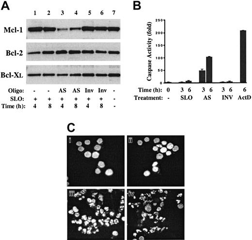 Fig. 5. Mcl-1 AS ODNs inhibit Mcl-1 protein levels and induce apoptosis of MM cells. / Mcl-1 AS ODN or inverted control ODN (Inv) was introduced into 8226 cells by means of streptolysin-O (SLO). (A) At 4 and 8 hours after transfection, cell lysates were prepared, and Western blot analysis was performed with the use of antibodies directed against Mcl-1, Bcl-2, or Bcl-XL. Lane 7 contains extracts from 8226 cells grown under standard conditions (complete medium plus IL-6). (B) At 3 or 6 hours after the introduction of AS or Inv ODN, cells were harvested and cell lysates analyzed for effector caspase activity. Extracts in the lane marked ActD were from cells cultured for 6 hours in the presence of actinomycin D (1 μg/mL). (C) The 8226 cells were treated with SLO alone (Ci), SLO plus Inv ODN (Cii), SLO plus AS ODN (Ciii), or actinomycin D (1 μg/mL) (Civ), and cultured for an additional 6 hours. Cytospin preparations were fixed and then stained with Hoechst 33342. Magnification, × 400.