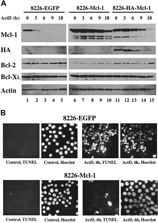 Fig. 6. Overexpression of Mcl-1 confers resistance to actinomycin D. / (A) Pools of 8226 cells were expanded after infection with recombinant lentiviruses expressing EGFP, Mcl-1, or HA–Mcl-1. Cells were cultured for the indicated times in medium containing actinomycin D, and protein extracts were subjected to Western blot analysis by means of antibodies with specificities as indicated along the left margin. (B) The 8226–EGFP or 8226–Mcl-1 pools were cultured in normal growth medium (control) or in medium containing actinomycin D for 6 hours. Cytospin preparations were assayed in situ by TUNEL and counterstained with Hoechst 33342. Identical fields are shown for each TUNEL/Hoechst pair (magnification, × 400).