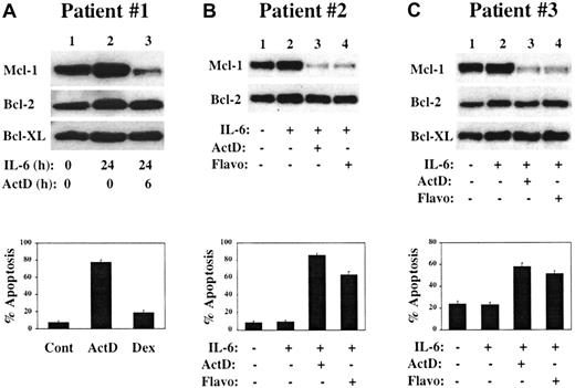 Fig. 8. Response of freshly isolated CD138+ cells to culture in actinomycin D or flavopiridol. / CD138+ cells were isolated from the BM of patients with relapsed MM. (A) Cells were cultured for the indicated times in the presence or absence of IL-6 (1 ng/mL) or actinomycin D (1 μg/mL), and protein extracts were subjected to Western blot analysis by means of antibodies with the specificities shown along the left margin. In the lower part of panel A, aliquots of CD138+ cells were cultured for 24 hours in medium containing IL-6 with the addition of actinomycin D (1 μg/mL) or dexamethasone (1 μM) for the final 6 hours. Cytospin preparations were analyzed by TUNEL with Hoechst 33342 counterstain. (B) CD138+ MM cells were cultured for 20 hours in the presence or absence of IL-6 (1 ng/mL) as indicated. Actinomycin D (1 μg/mL) or flavopiridol (200 nM) was added to the indicated cultures for the entire 20-hour incubation period, after which some cells were harvested for Western blot analysis while others were used in TUNEL assays (lower portion of the panel). (C) CD138+ BM cells from a third MM patient were treated as described in panel B, except that the cells were cultured for a 6-hour period.