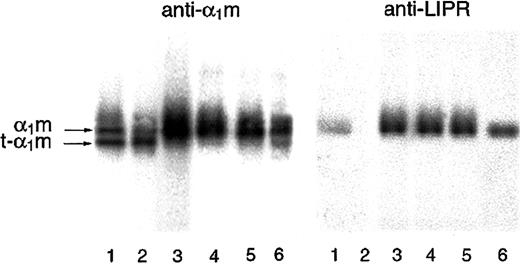 Fig. 6. SDS-PAGE of urinary α1m. / Urinary α1m was purified by affinity chromatography on a column with monoclonal antibodies against α1m. The eluate was analyzed by SDS-PAGE in the presence of mercaptoethanol (T = 12%, C = 3,3), staining, and Western blotting with anti-α1m and anti LIPR. Urine from apparently healthy donors (lanes 4-6) as well as patients having different disorders associated with the following changes in erythrocyte formation and destruction were used: lane 1, suspected mechanical hemolytic anemia associated with mitral valve reconstruction following endocarditis; lane 2, autoimmune hemolytic anemia (warm type, IgG-mediated); lane 3, paroxysmal nocturnal hemoglobinuria and myelodysplastic syndrome.